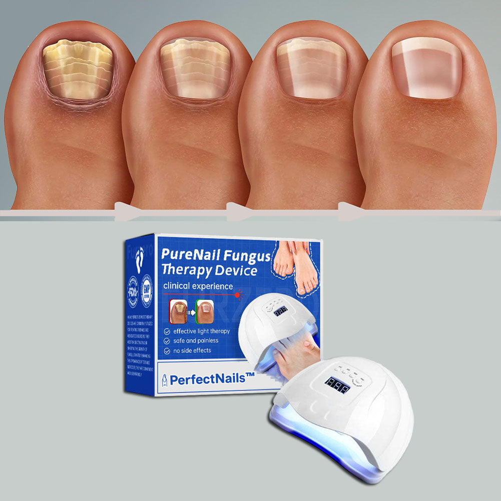 PerfectNails™ | מכשיר לטיפול בפטרת בציפורניים באמצעות לייזר