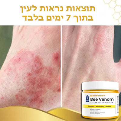 BeeRenew