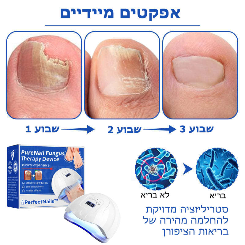 PerfectNails™ | מכשיר לטיפול בפטרת בציפורניים באמצעות לייזר