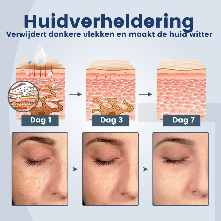 DermSkin