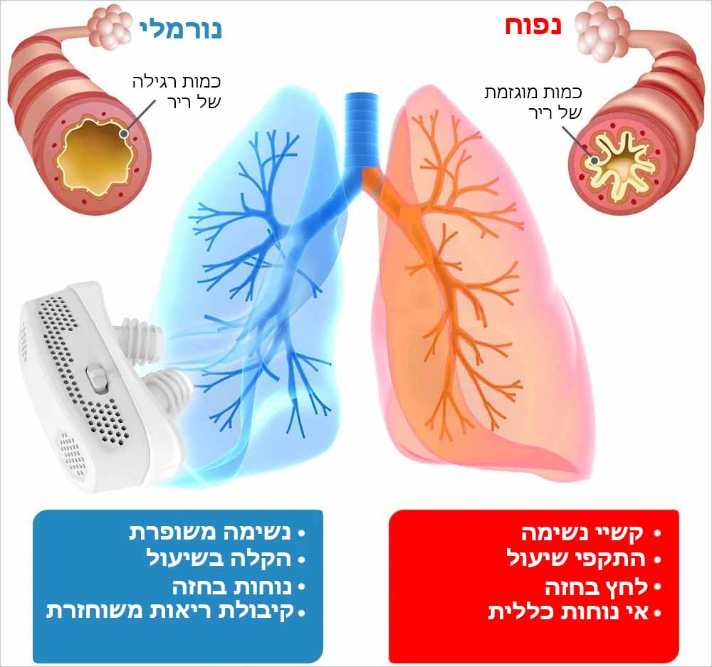 LungShield™ | מסנן נשימה לניקוי הריאות